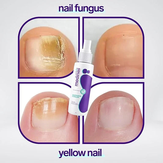 Jaysuin Nail Fungus Care Spray – 100ml