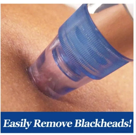 Pore Cleaning Device – Blackhead Remover