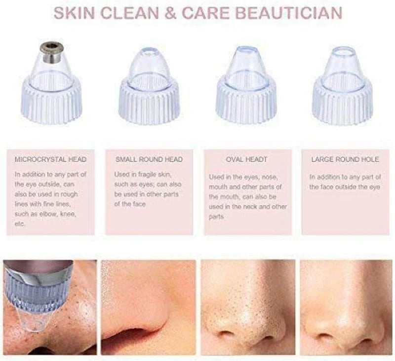 Pore Cleaning Device – Blackhead Remover
