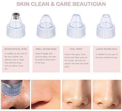 Pore Cleaning Device – Blackhead Remover