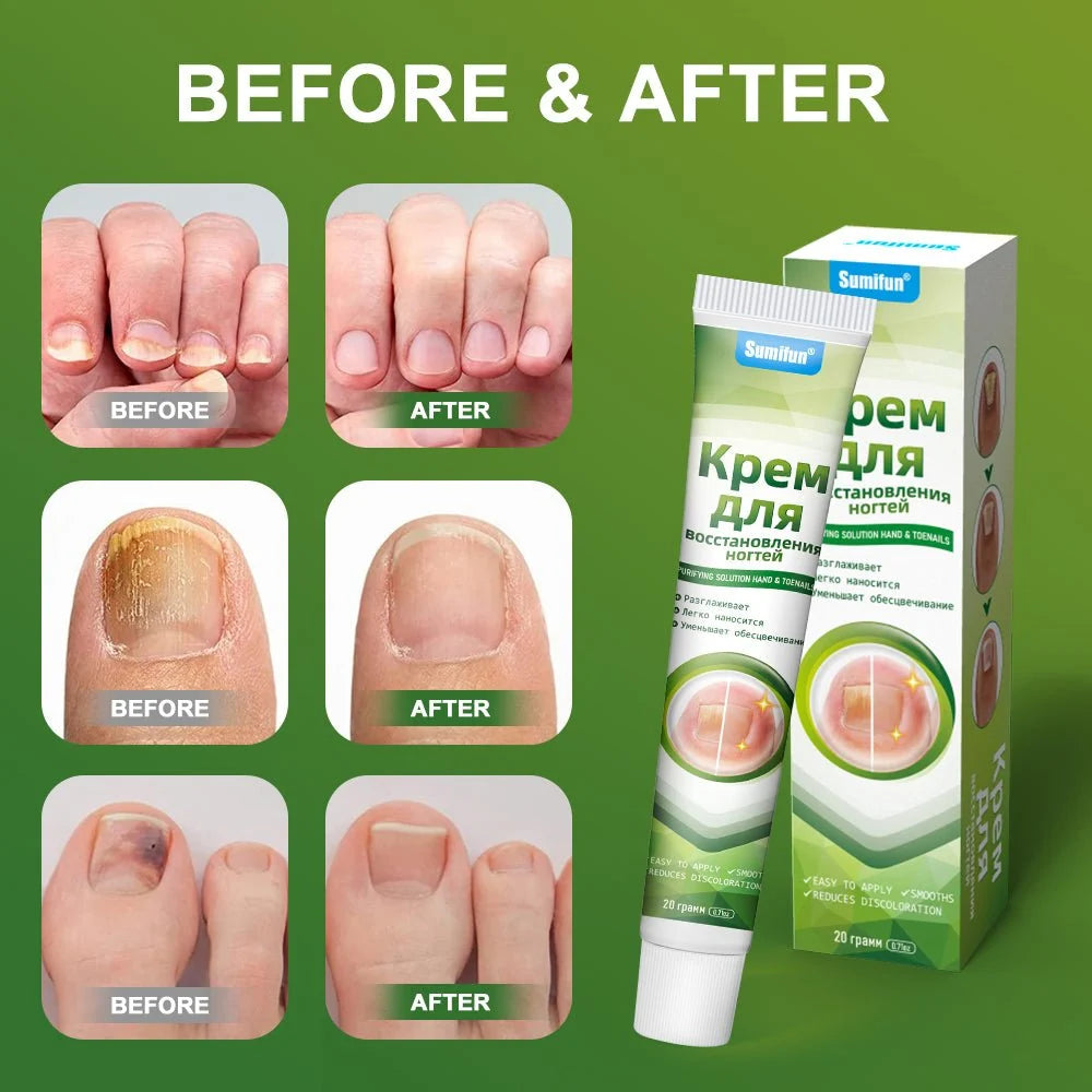 Sumifun Nail Treatment Repair Gel – 20g