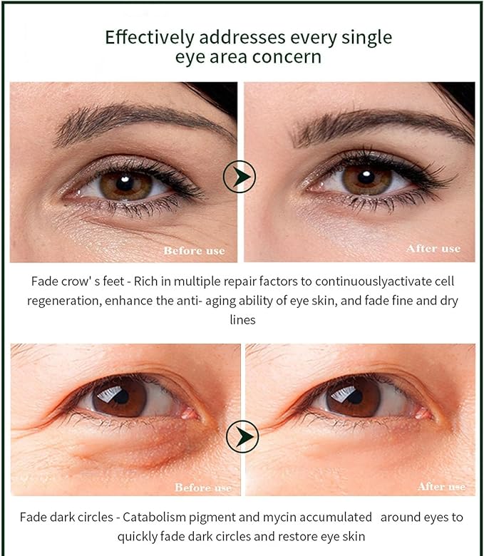 Time Eraser Eye Essence Oil – 10ml