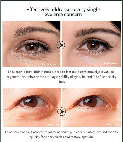 Time Eraser Eye Essence Oil – 10ml